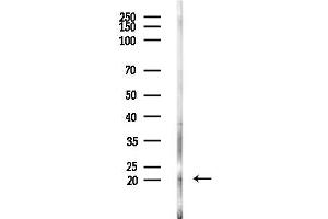 anti-Pituitary Tumor-Transforming 1 (PTTG1) (C-Term) antibody