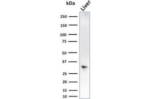 Western Blot Analysis of liver tissue lysate using SULT1E1 Mouse Monoclonal Antibody (CPTC-SULT1E1-1). (SULT1E1 Antikörper)