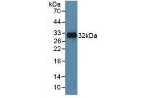 Western blot analysis of recombinant Human MAPK8. (JNK Antikörper  (AA 145-419))