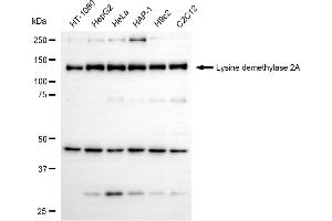 Western blotting analysis using lysine demethylase 2A antibody (ABIN7799299). (Rekombinanter KDM2A Antikörper)