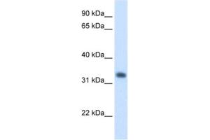Western Blotting (WB) image for anti-3-Hydroxymethyl-3-Methylglutaryl-CoA Lyase (HMGCL) antibody (ABIN2462454) (HMGCL Antikörper)