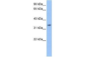 Beta Lactamase antibody used at 1 ug/ml to detect target protein.