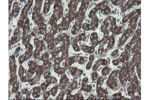 Image no. 9 for anti-NADH Dehydrogenase (Ubiquinone) 1 beta Subcomplex, 10, 22kDa (NDUFB10) antibody (ABIN1499668)