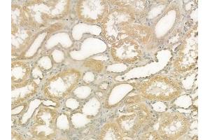 ABIN6265566 and ABIN6276558 at 1/100 staining human normal kidney tissue by IHC-P. (TICAM1 Antikörper  (Internal Region))