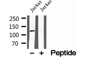 Western blot analysis of extracts of Jurkat cells, using MICAL1 antibody. (MICAL1 Antikörper  (Internal Region))