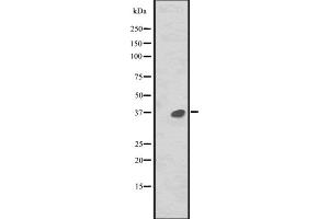 Western blot analysis of MAPRE2 expression in CEM cell line lysate ,The lane on the left is treated with the antigen-specific peptide. (MAPRE2 Antikörper  (Internal Region))