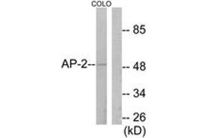 Western blot analysis of extracts from COLO205 cells, using AP-2 Antibody. (TFAP2A Antikörper  (AA 388-437))