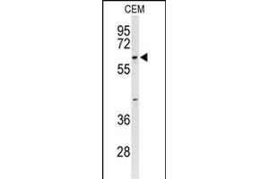 Western blot analysis of TCHP Antibody (Center) (ABIN653303 and ABIN2842803) in CEM cell line lysates (35 μg/lane). (TCHP Antikörper  (AA 291-320))