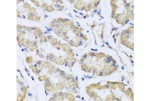 Immunohistochemistry of paraffin-embedded Human stomach using RCN2 Polyclonal Antibody at dilution of 1:100 (40x lens).