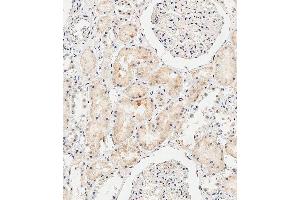 Immunohistochemical analysis of paraffin-embedded Human kidney tissue using B performed on the Leica® BOND RXm. (COL8a2 Antikörper  (C-Term))