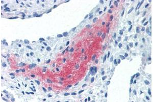 Human Uterus, Myometrium (formalin-fixed, paraffin-embedded) stained with LEFTY2 antibody ABIN337262 at 10 ug/ml followed by biotinylated anti-mouse IgG secondary antibody ABIN481714, alkaline phosphatase-streptavidin and chromogen. (LEFTY2 Antikörper)