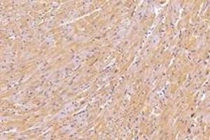 Immunohistochemistry analysis of paraffin-embedded mouse heart using,KIF5B (ABIN7074440) at dilution of 1: 1000 (KIF5B Antikörper)