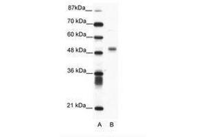Image no. 1 for anti-Friend Leukemia Virus Integration 1 (FLI1) (N-Term) antibody (ABIN202560) (FLI1 Antikörper  (N-Term))