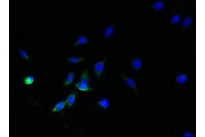 Immunofluorescent analysis of HepG2 cells using ABIN7170902 at dilution of 1:100 and Alexa Fluor 488-congugated AffiniPure Goat Anti-Rabbit IgG(H+L) (SDHC Antikörper  (AA 30-62))