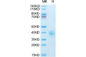 Human BTLA on Tris-Bis PAGE under reduced condition. (BTLA Protein (AA 31-150) (His-Avi Tag))