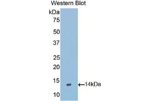 Western blot analysis of the recombinant protein. (GNRH1 Antikörper  (AA 25-92))