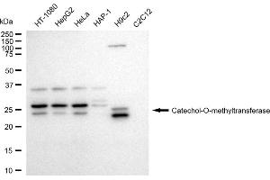 Western blotting analysis using Catechol-O-methyltransferase antibody (ABIN7797922).