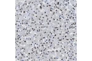 Immunohistochemical staining of human liver with OGFR polyclonal antibody  shows nuclear positivity in hepatocytes at 1:50-1:200 dilution.