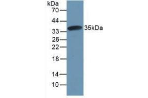 Western blot analysis of recombinant Rat CAPN1. (CAPNL1 Antikörper  (AA 387-694))