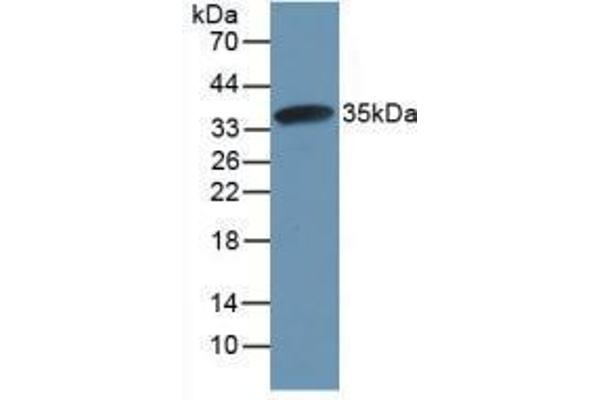 CAPNL1 Antikörper  (AA 387-694)