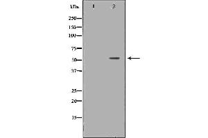 Western blot analysis of Hela whole cell lysates, using IRF5  Antibody. (IRF5 Antikörper  (C-Term))
