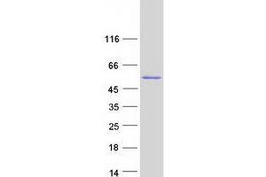 Validation with Western Blot (TBRG1 Protein (Transcript Variant 1) (Myc-DYKDDDDK Tag))