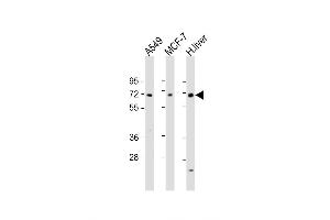 Western Blot at 1:1000-1:2000 dilution Lane 1: A549 whole cell lysate Lane 2: MCF-7 whole cell lysate Lane 3: human liver lysate Lysates/proteins at 20 ug per lane. (HABP2 Antikörper  (C-Term))