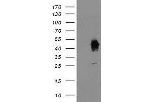 Western Blotting (WB) image for anti-Activating Signal Cointegrator 1 Complex Subunit 1 (ASCC1) antibody (ABIN1496742)
