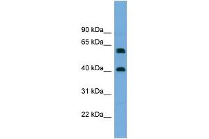 WB Suggested Anti-TERF2IP  Antibody Titration: 0. (RAP1 Antikörper  (Middle Region))