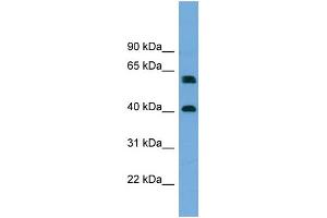WB Suggested Anti-TERF2IP  Antibody Titration: 0.