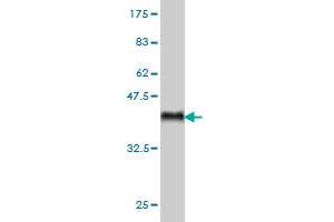 Western Blot detection against Immunogen (36. (ARAF Antikörper  (AA 151-250))