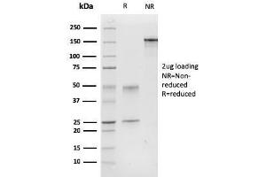 SDS-PAGE Analysis Purified Calponin-1 Mouse Monoclonal Antibody (CNN1/832). (CNN1 Antikörper)