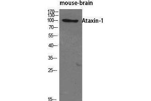 Western Blotting (WB) image for anti-Ataxin 1 (ATXN1) (Tyr1021) antibody (ABIN3183406) (Ataxin 1 Antikörper  (Tyr1021))