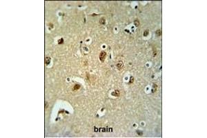 Immunohistochemistry (Paraffin-embedded Sections) (IHC (p)) image for anti-UDP-Gal:betaGal beta 1,3-Galactosyltransferase Polypeptide 6 (B3GALT6) (AA 241-269), (C-Term) antibody (ABIN651201)