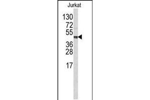 Western blot analysis of in Jurkat cell line lysates (35ug/lane) (CPB2 Antikörper  (AA 119-148))