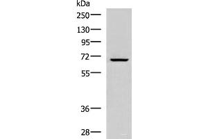 Western blot analysis of Raji cell lysate using CACNB1 Polyclonal Antibody at dilution of 1:800 (CACNB1 Antikörper)