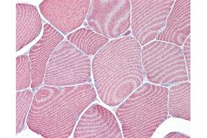 Immunohistochemistry (IHC) image for anti-Fatty Acid Binding Protein 3, Muscle and Heart (FABP3) (AA 36-85) antibody (ABIN6748607)