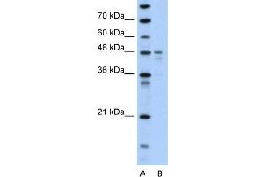 WB Suggested Anti-PDK4 Antibody Titration:  0. (PDK4 Antikörper  (N-Term))