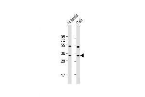 Western Blot at 1:1000 dilution Lane 1: human testis lysate Lane 2: Raji whole cell lysate Lysates/proteins at 20 ug per lane. (HSD17B3 Antikörper  (AA 89-118))