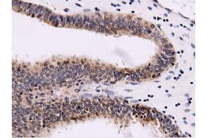 Immunohistochemical staining of paraffin-embedded Human liver tissue using anti-CBWD1 mouse monoclonal antibody. (CBWD1 Antikörper)