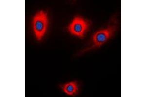 Immunofluorescent analysis of Kalirin staining in NIH3T3 cells. (KALRN Antikörper  (Center))
