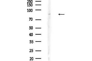 anti-Bardet-Biedl Syndrome 2 (BBS2) (C-Term) antibody