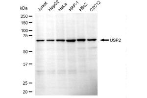 Western blotting analysis using USP2 antibody (ABIN7800729).