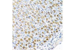 Immunohistochemistry of paraffin-embedded mouse stomach using FECH antibody (ABIN5974679) at dilution of 1/100 (40x lens). (FECH Antikörper)