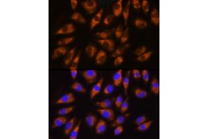 Immunofluorescence analysis of L929 cells using GRK5 Rabbit pAb (ABIN1680115, ABIN3018251, ABIN3018252 and ABIN6220413) at dilution of 1:100 (40x lens). (GRK5 Antikörper  (AA 371-590))