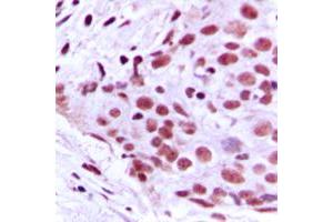 Immunohistochemistry (IHC) image for anti-Minichromosome Maintenance Complex Component 2 (MCM2) (N-Term) antibody (ABIN7296270)