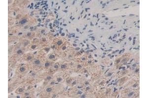 Detection of MAPKAPK2 in Human Liver Tissue using Polyclonal Antibody to MAP Kinase Activated Protein Kinase 2 (MAPKAPK2) (MAPKAP Kinase 2 Antikörper  (AA 139-367))