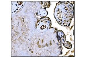 IHC analysis of IGF2R using anti-IGF2R antibody (ABIN7601706). (IGF2R Antikörper  (AA 424-529))