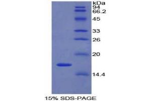 SDS-PAGE analysis of Rat LYAR Protein. (LYAR Protein)