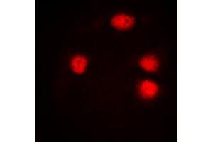 Immunofluorescent analysis of ZIC1/2/3 staining in Jurkat cells. (ZIC1/2/3 Antikörper  (Center))